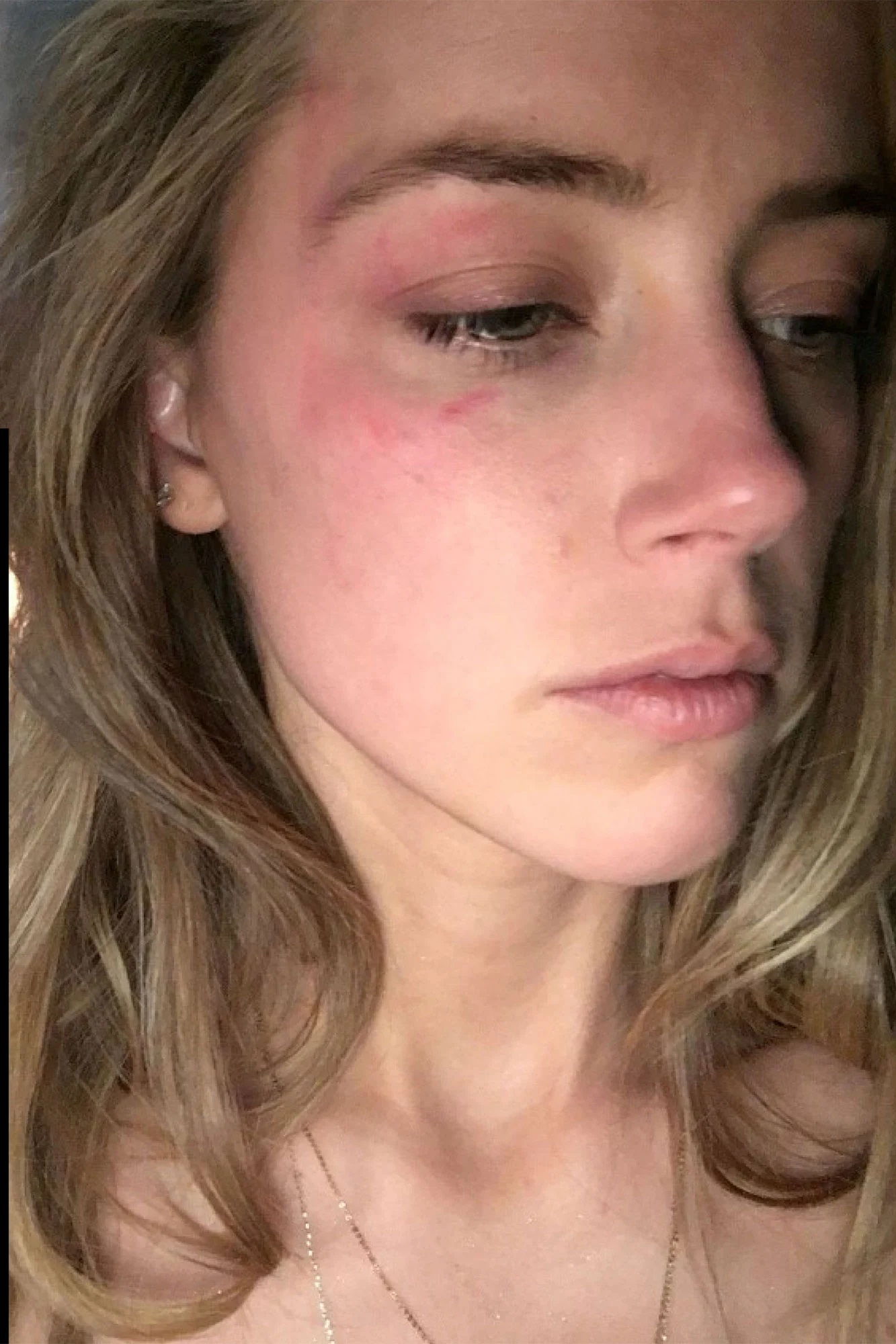 Amber Heard Abusesd Photo 1