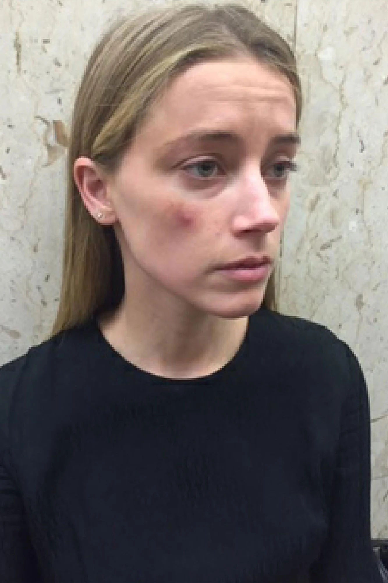 Amber Heard Abusesd Photo 3