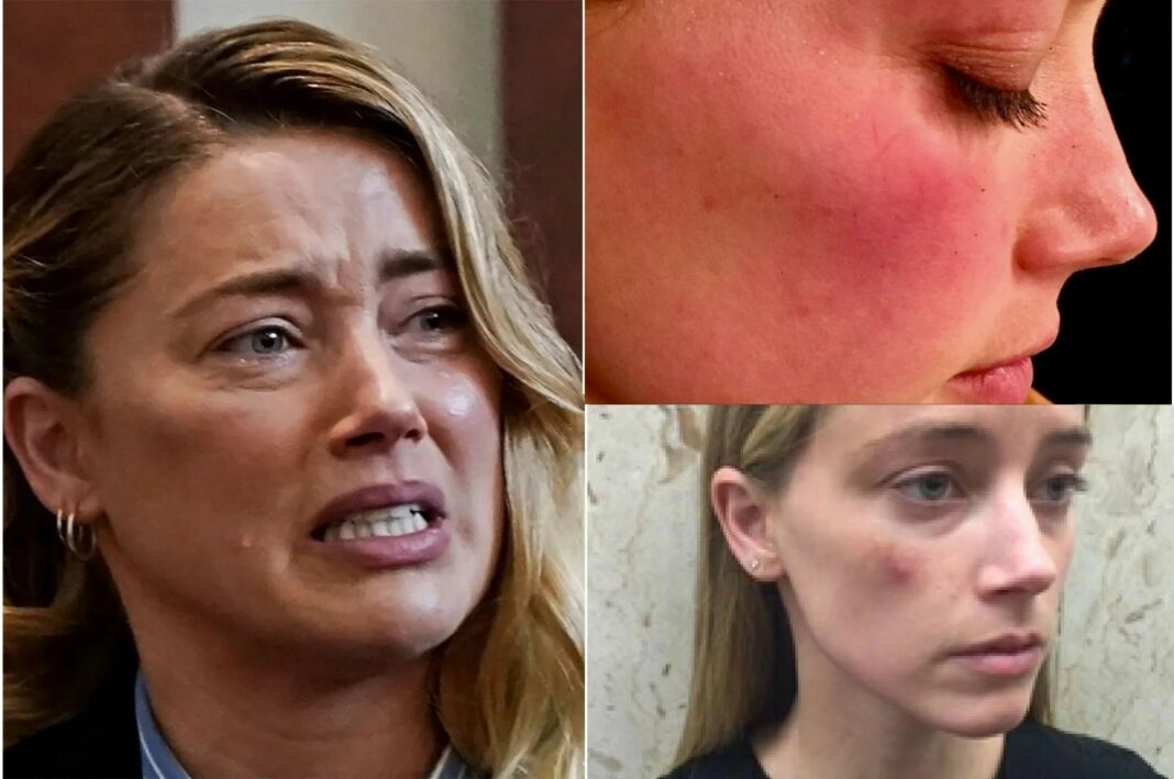 Are Amber Heard Abused Face Photos Photoshopped?