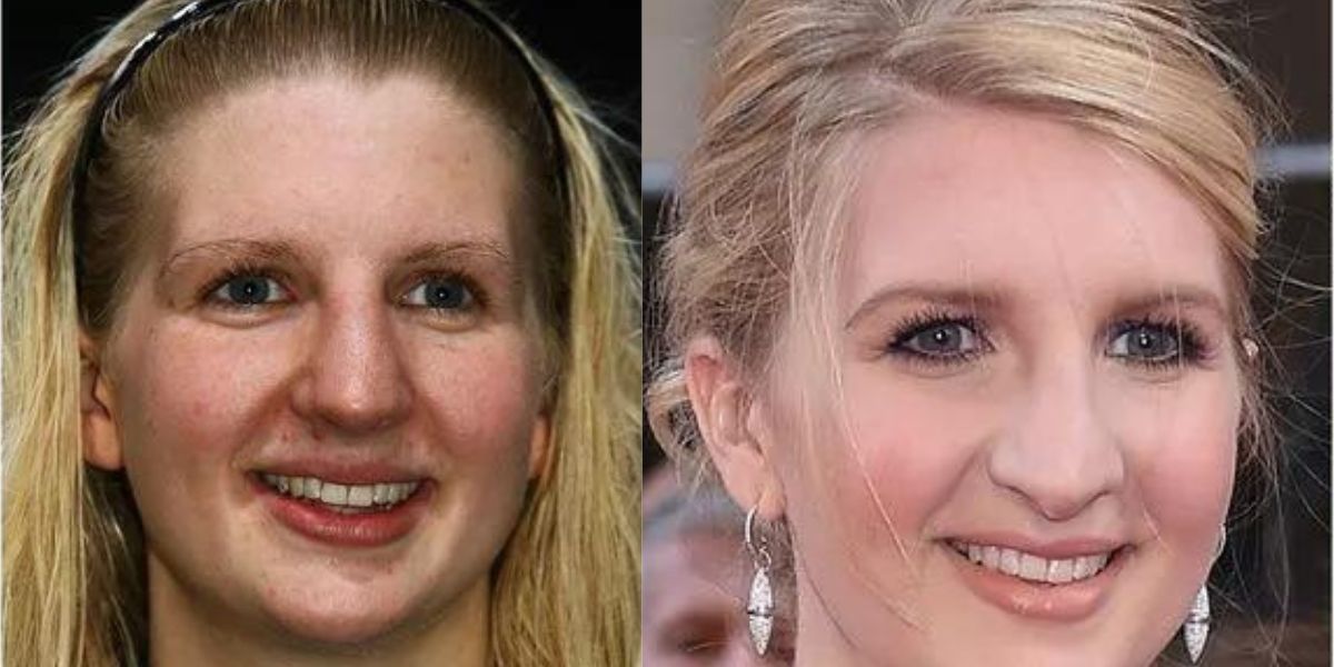 Rebecca Adlington